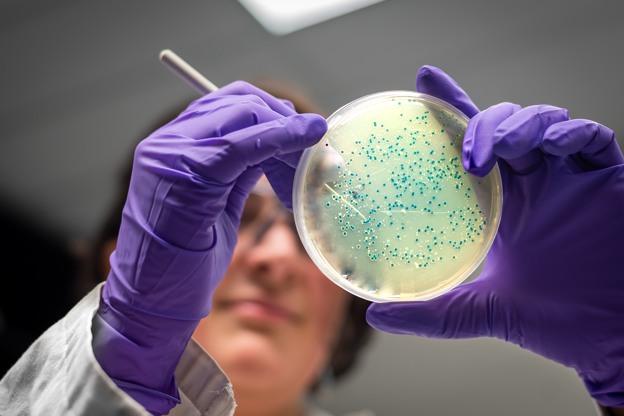 Lab analyst with petri dish